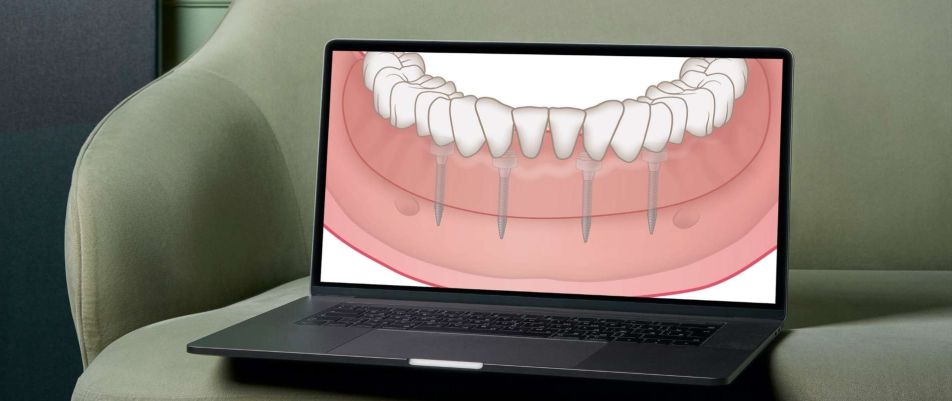 Ein Laptop zeigt ein Zahnmodell mit Miniimplantaten, das auf einem grünen Sessel präsentiert wird.
