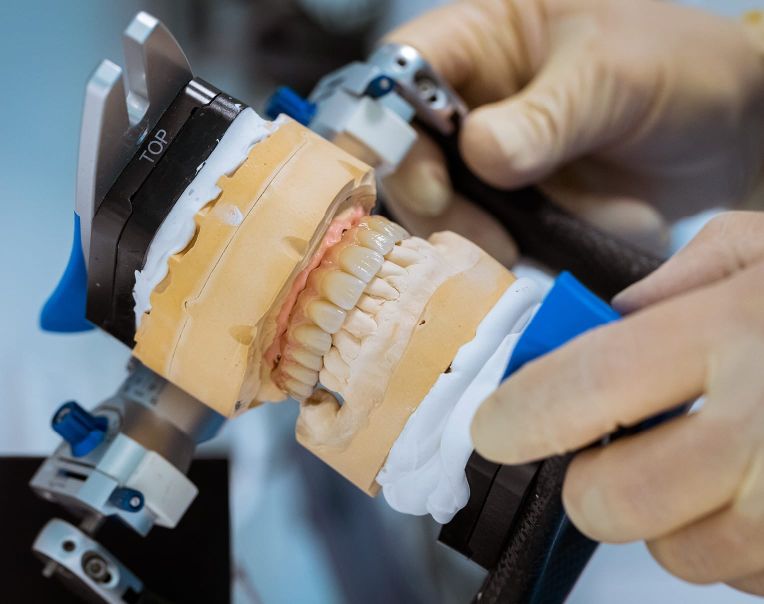 Hochwertiger Zahnersatz - Zahnimplantate Plettenberg